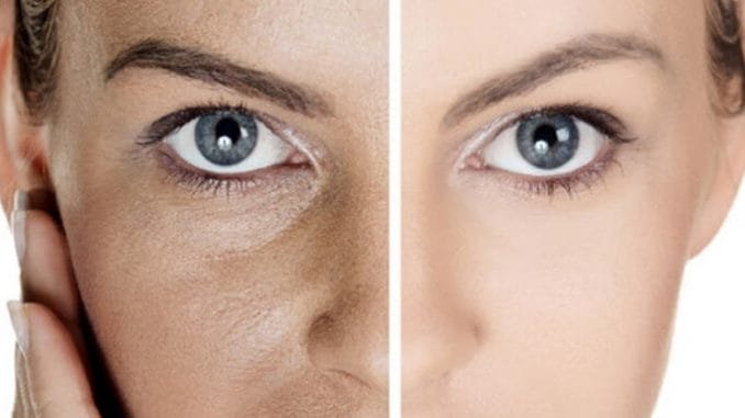 Large-Pores-on-Face tips membersihkan pori-pori